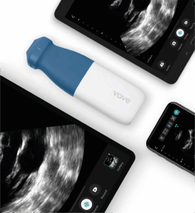 vave-ultrassom-sem-fio-portatil-exame-imagem-medica