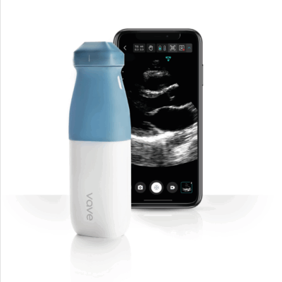 vave-ultrassom-sem-fio-portatil-exame-imagem-medica